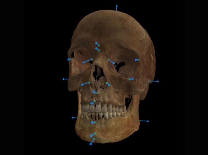 Craniofacial Superimposition Advanced Course